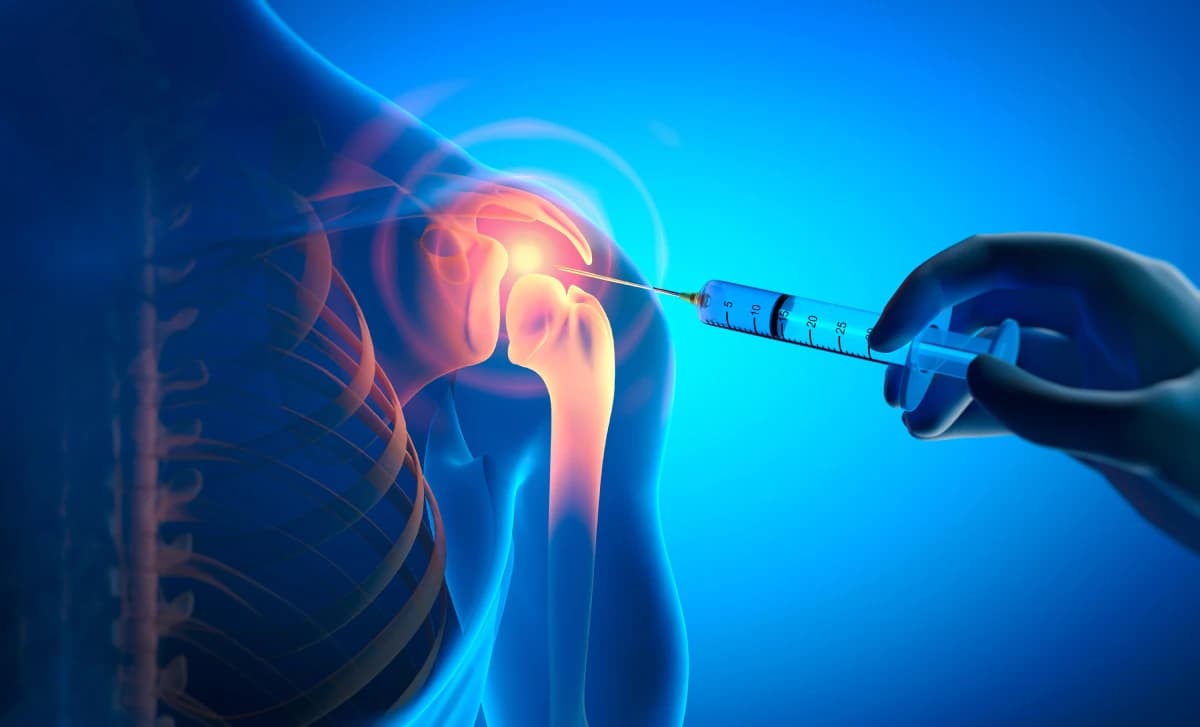 Alternatives to Rotator Cuff and Shoulder Surgery