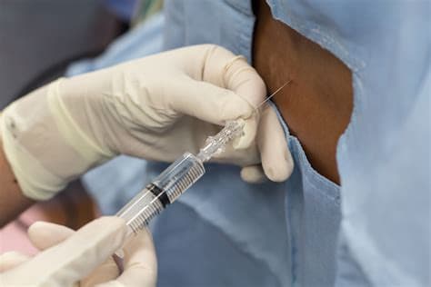 Lumbar Epidural Steroid Injections: What to Expect at Your Appointment