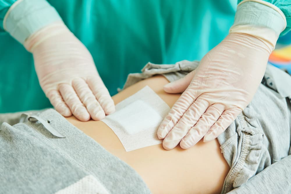 Hernia Surgery: What to Expect and How Long Recovery Actually Takes